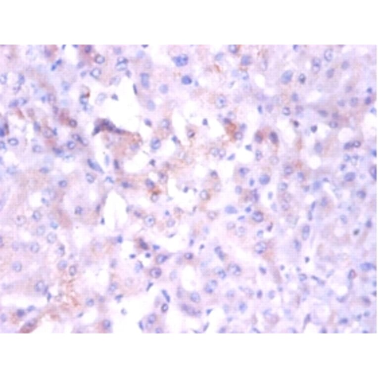 Immunohistochemistry - 42282 from Signalway Antibody - Antibodies.com