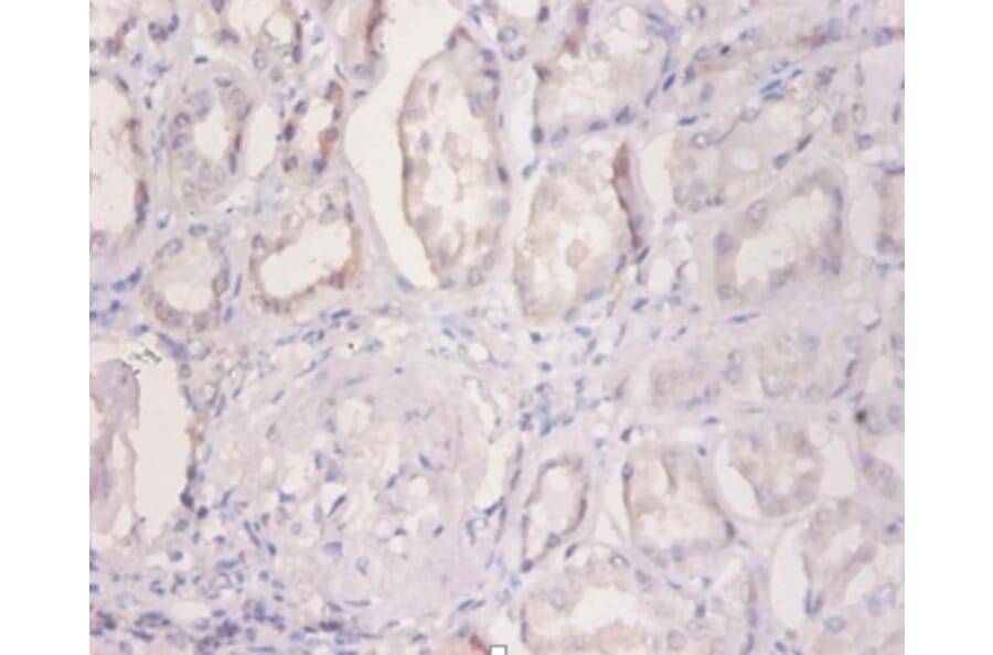 Immunohistochemistry - 42381 from Signalway Antibody - Antibodies.com