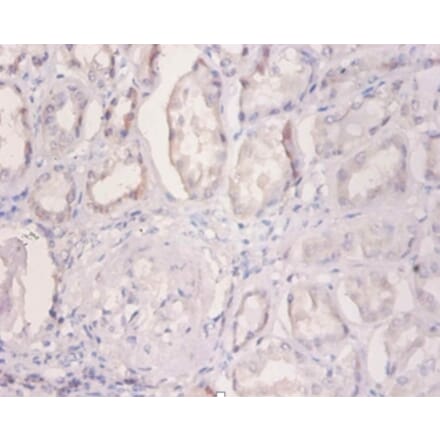 Immunohistochemistry - 42381 from Signalway Antibody - Antibodies.com