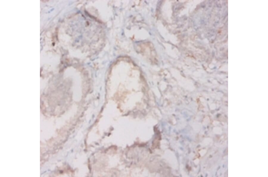 Immunohistochemistry - 42589 from Signalway Antibody - Antibodies.com