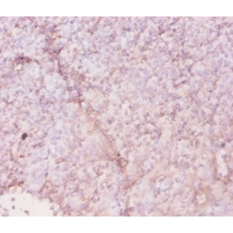Immunohistochemistry - 42616 from Signalway Antibody - Antibodies.com
