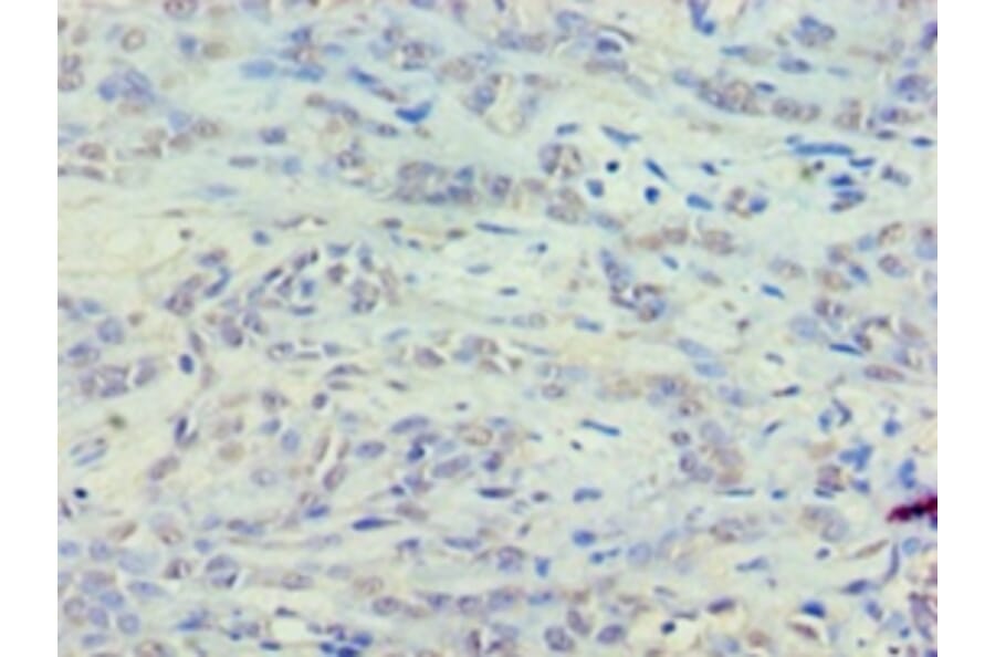Immunohistochemistry - 42155 from Signalway Antibody - Antibodies.com