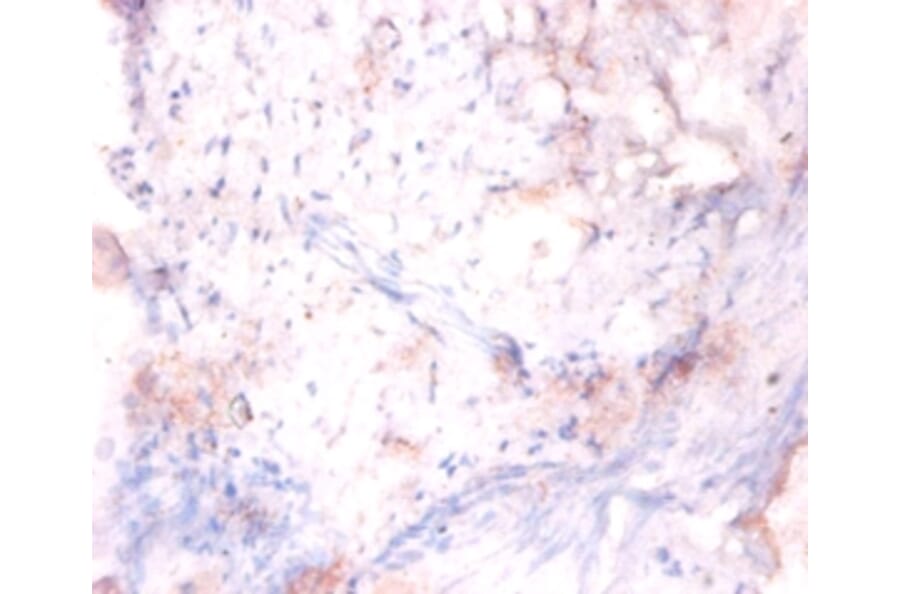 Immunohistochemistry - 42245 from Signalway Antibody - Antibodies.com