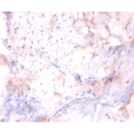 Immunohistochemistry - 42245 from Signalway Antibody - Antibodies.com