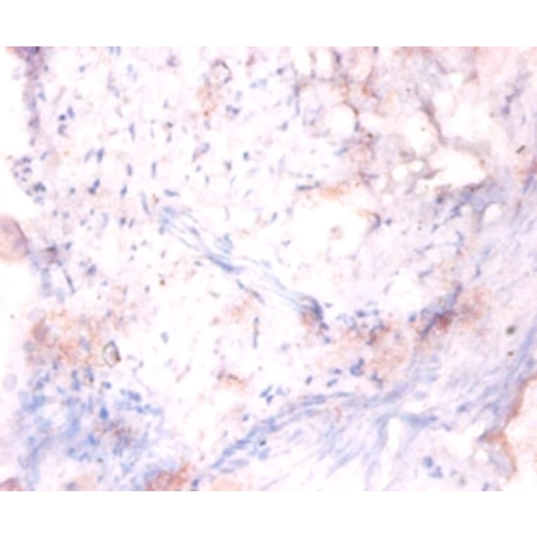 Immunohistochemistry - 42245 from Signalway Antibody - Antibodies.com