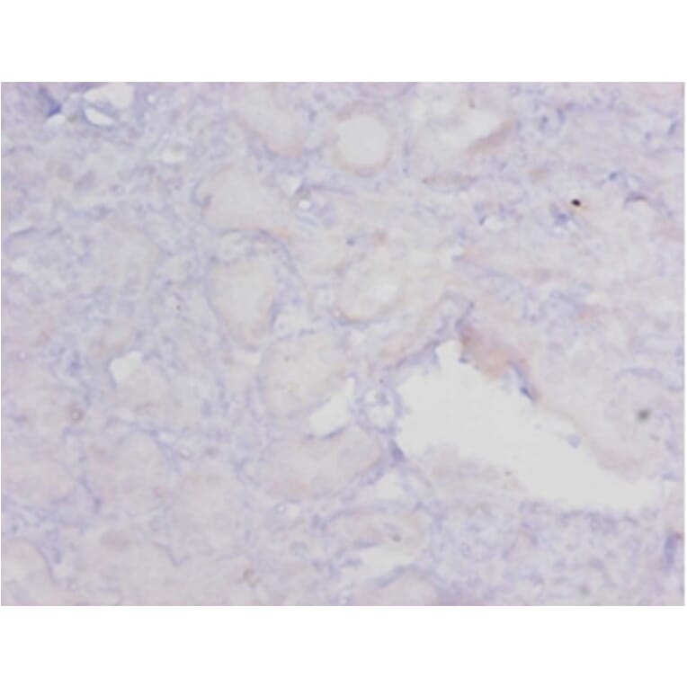 Immunohistochemistry - 42551 from Signalway Antibody - Antibodies.com