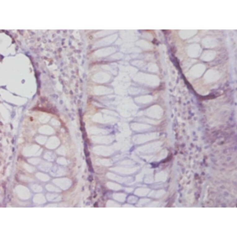 Immunohistochemistry - 42551 from Signalway Antibody - Antibodies.com