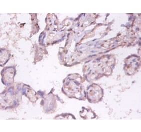 Immunohistochemistry - Tumor necrosis factor ligand superfamily member 9 Polyclonal Antibody from Signalway Antibody (42498)