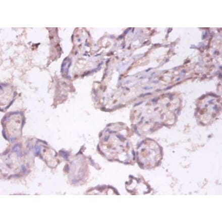 Immunohistochemistry - Tumor necrosis factor ligand superfamily member 9 Polyclonal Antibody from Signalway Antibody (42498)