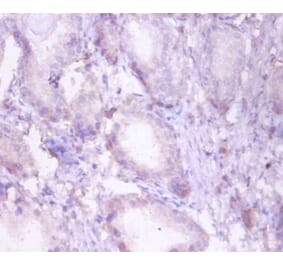 Immunohistochemistry - Trifunctional enzyme subunit beta, mitochondrial Polyclonal Antibody from Signalway Antibody (42383)