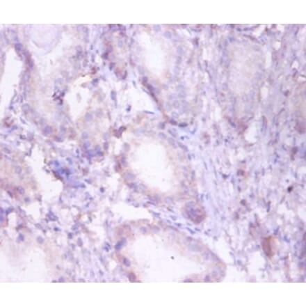 Immunohistochemistry - Trifunctional enzyme subunit beta, mitochondrial Polyclonal Antibody from Signalway Antibody (42383)