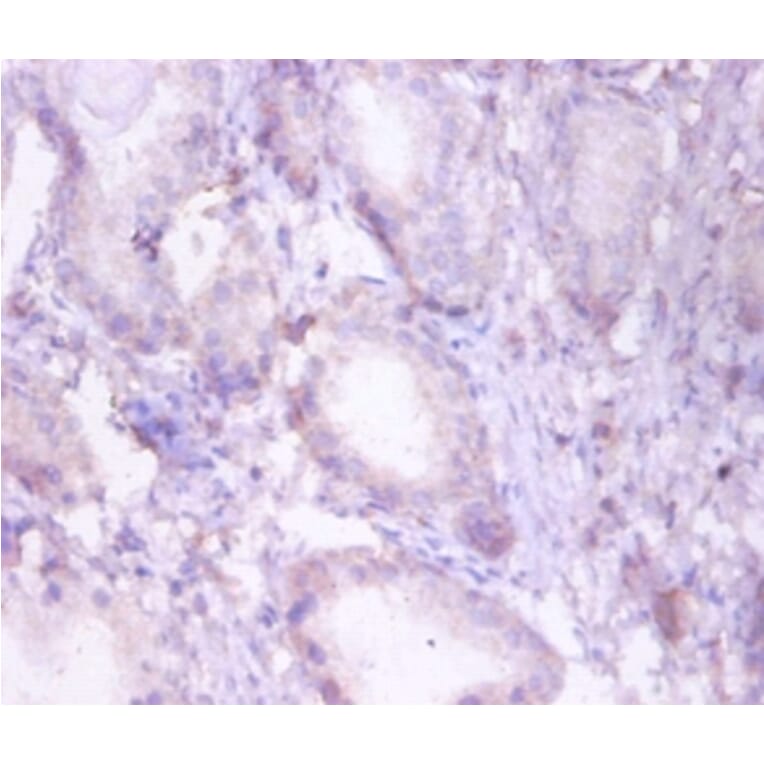 Immunohistochemistry - Trifunctional enzyme subunit beta, mitochondrial Polyclonal Antibody from Signalway Antibody (42383)