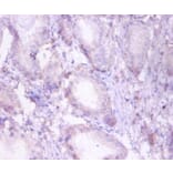 Immunohistochemistry - Trifunctional enzyme subunit beta, mitochondrial Polyclonal Antibody from Signalway Antibody (42383)