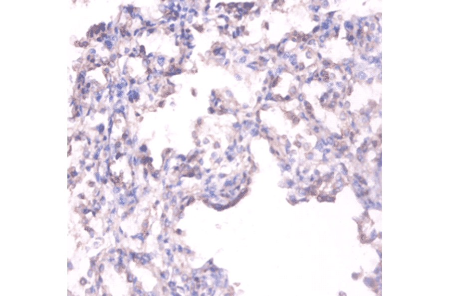 Immunohistochemistry - Alkaline phosphatase, tissue-nonspecific isozyme Polyclonal Antibody from Signalway Antibody (42555)