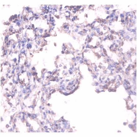 Immunohistochemistry - Alkaline phosphatase, tissue-nonspecific isozyme Polyclonal Antibody from Signalway Antibody (42555)