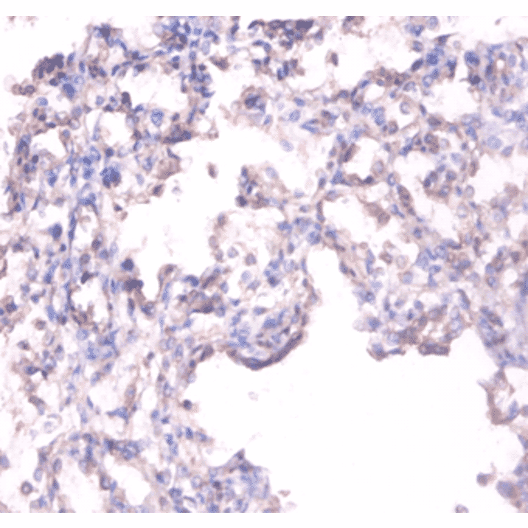 Immunohistochemistry - Alkaline phosphatase, tissue-nonspecific isozyme Polyclonal Antibody from Signalway Antibody (42555)