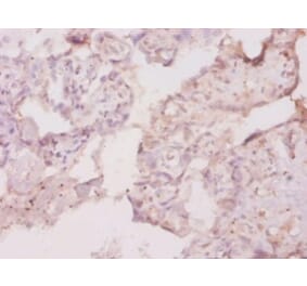 Immunohistochemistry - Macrophage colony-stimulating factor 1 receptor Polyclonal Antibody from Signalway Antibody (42493)