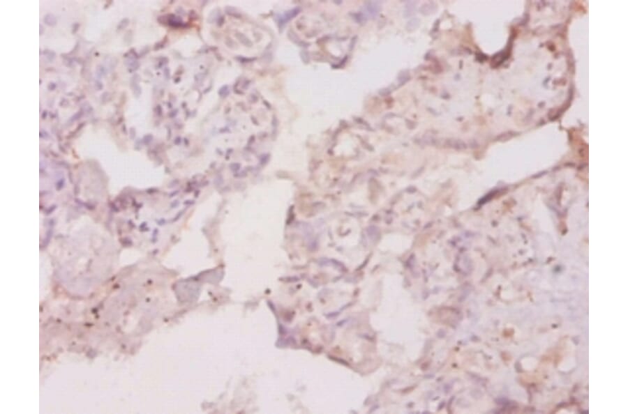 Immunohistochemistry - Macrophage colony-stimulating factor 1 receptor Polyclonal Antibody from Signalway Antibody (42493)