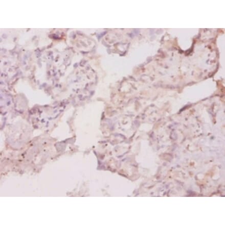 Immunohistochemistry - Macrophage colony-stimulating factor 1 receptor Polyclonal Antibody from Signalway Antibody (42493)
