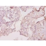 Immunohistochemistry - Macrophage colony-stimulating factor 1 receptor Polyclonal Antibody from Signalway Antibody (42493)