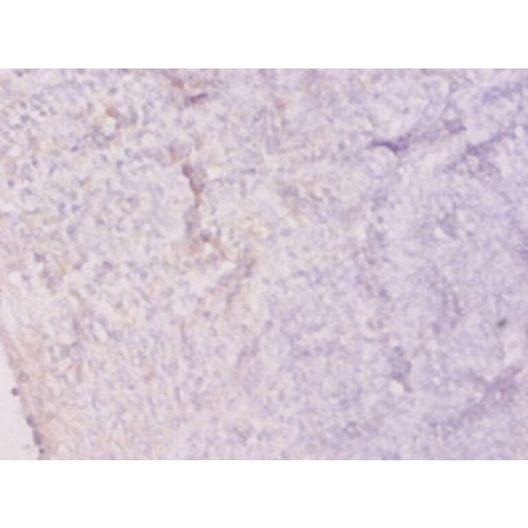 Immunohistochemistry - Hypoxanthine-guanine phosphoribosyltransferase Polyclonal Antibody from Signalway Antibody (42599)