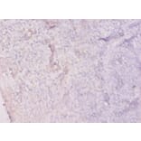 Immunohistochemistry - Hypoxanthine-guanine phosphoribosyltransferase Polyclonal Antibody from Signalway Antibody (42599)