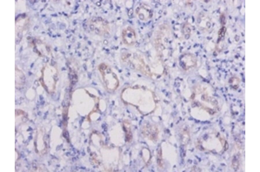 Immunohistochemistry - Hepatitis A virus cellular receptor 1 homolog Polyclonal Antibody from Signalway Antibody (42610)