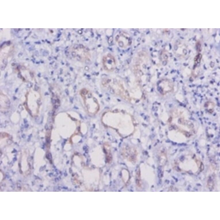 Immunohistochemistry - Hepatitis A virus cellular receptor 1 homolog Polyclonal Antibody from Signalway Antibody (42610)