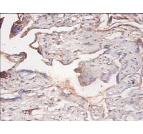 Immunohistochemistry - PHD finger-like domain-containing protein 5A Polyclonal Antibody from Signalway Antibody (42290)