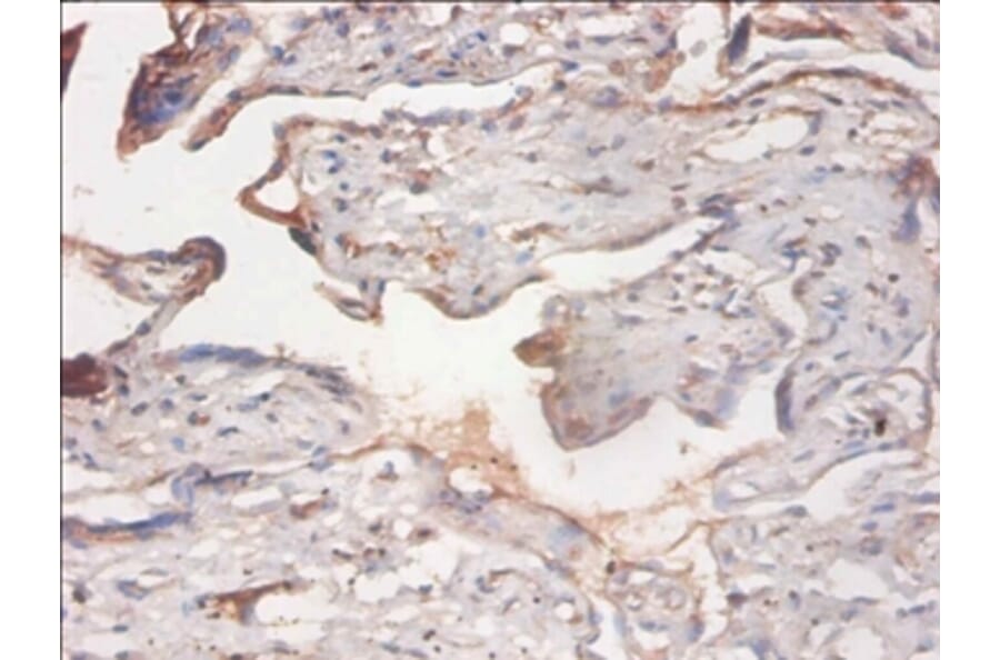 Immunohistochemistry - PHD finger-like domain-containing protein 5A Polyclonal Antibody from Signalway Antibody (42290)