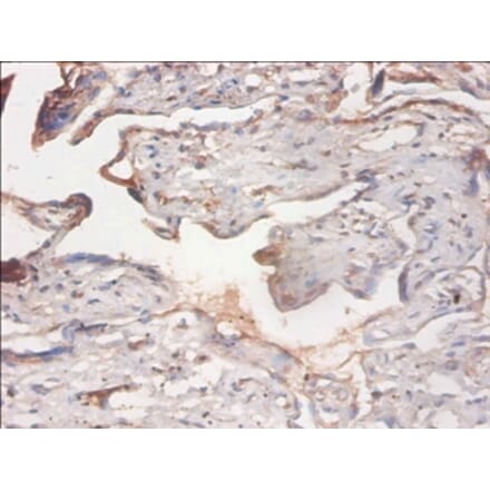 Immunohistochemistry - PHD finger-like domain-containing protein 5A Polyclonal Antibody from Signalway Antibody (42290)