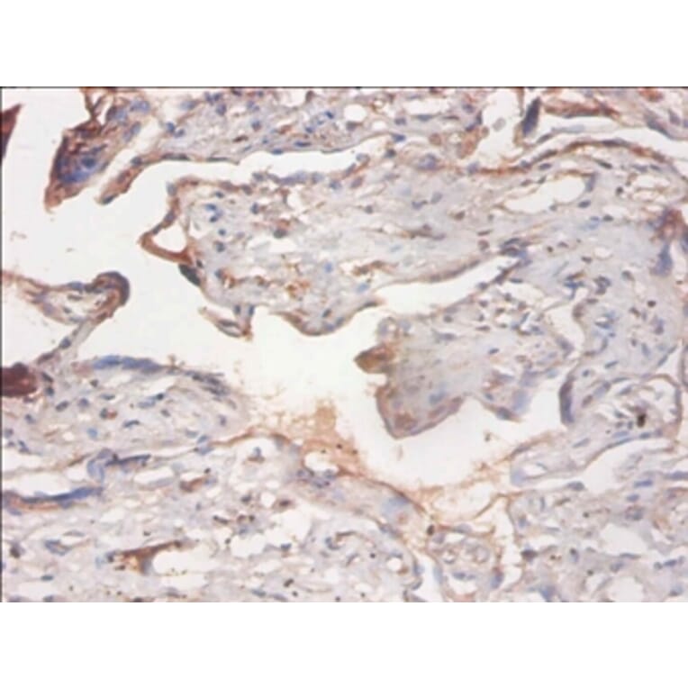 Immunohistochemistry - PHD finger-like domain-containing protein 5A Polyclonal Antibody from Signalway Antibody (42290)