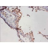Immunohistochemistry - PHD finger-like domain-containing protein 5A Polyclonal Antibody from Signalway Antibody (42290)