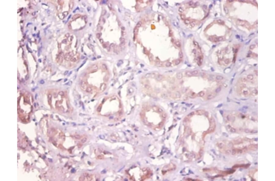 Immunohistochemistry - Dehydrogenase/reductase SDR family member 9 Polyclonal Antibody from Signalway Antibody (42147)