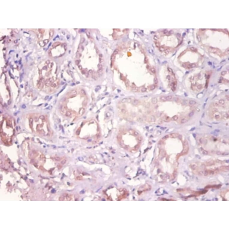 Immunohistochemistry - Dehydrogenase/reductase SDR family member 9 Polyclonal Antibody from Signalway Antibody (42147)