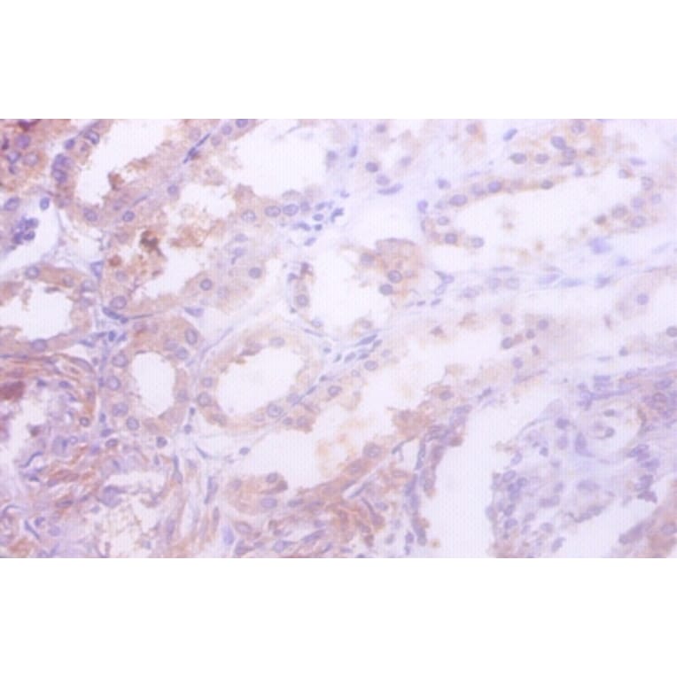 Immunohistochemistry - Isocitrate dehydrogenase [NADP] cytoplasmic Polyclonal Antibody from Signalway Antibody (42216)