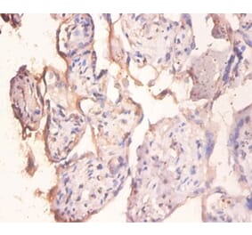 Immunohistochemistry - Protein phosphatase 1 regulatory subunit 11 Polyclonal Antibody from Signalway Antibody (42403)