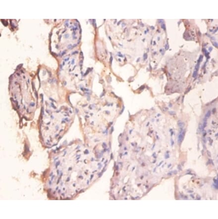 Immunohistochemistry - Protein phosphatase 1 regulatory subunit 11 Polyclonal Antibody from Signalway Antibody (42403)