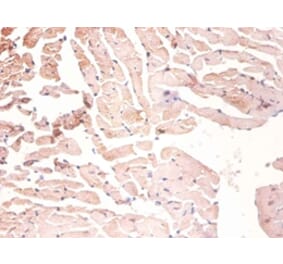 Immunohistochemistry - Heterogeneous nuclear ribonucleoprotein A1 Polyclonal Antibody from Signalway Antibody (42208)