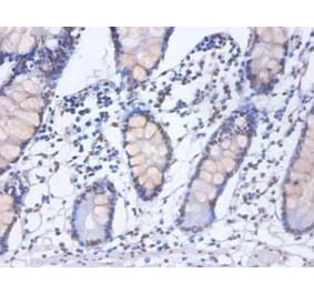 Immunohistochemistry - Heterogeneous nuclear ribonucleoprotein D0 Polyclonal Antibody from Signalway Antibody (42362)