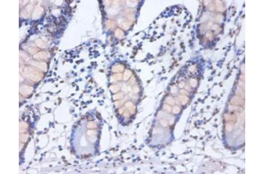 Immunohistochemistry - Heterogeneous nuclear ribonucleoprotein D0 Polyclonal Antibody from Signalway Antibody (42362)