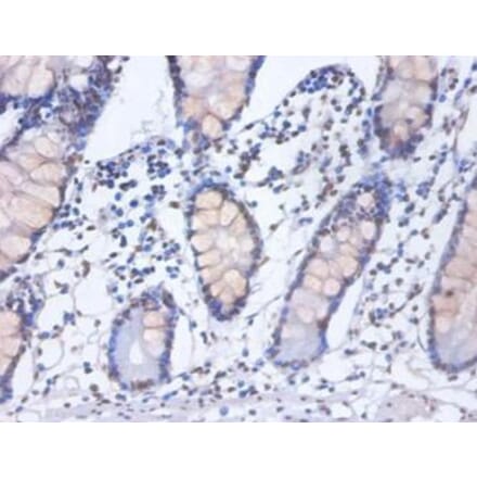Immunohistochemistry - Heterogeneous nuclear ribonucleoprotein D0 Polyclonal Antibody from Signalway Antibody (42362)
