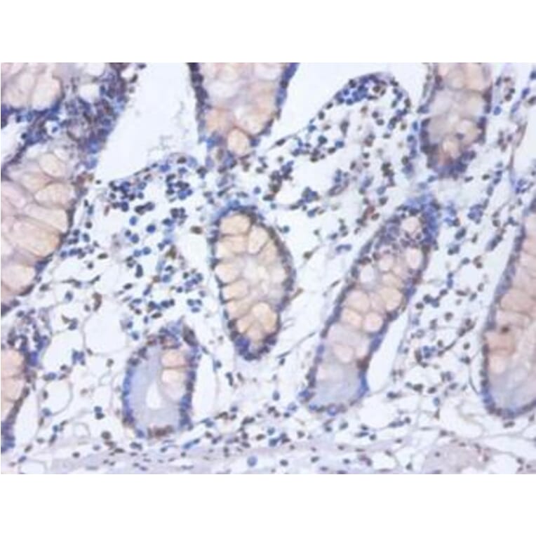 Immunohistochemistry - Heterogeneous nuclear ribonucleoprotein D0 Polyclonal Antibody from Signalway Antibody (42362)