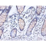 Immunohistochemistry - Heterogeneous nuclear ribonucleoprotein D0 Polyclonal Antibody from Signalway Antibody (42362)