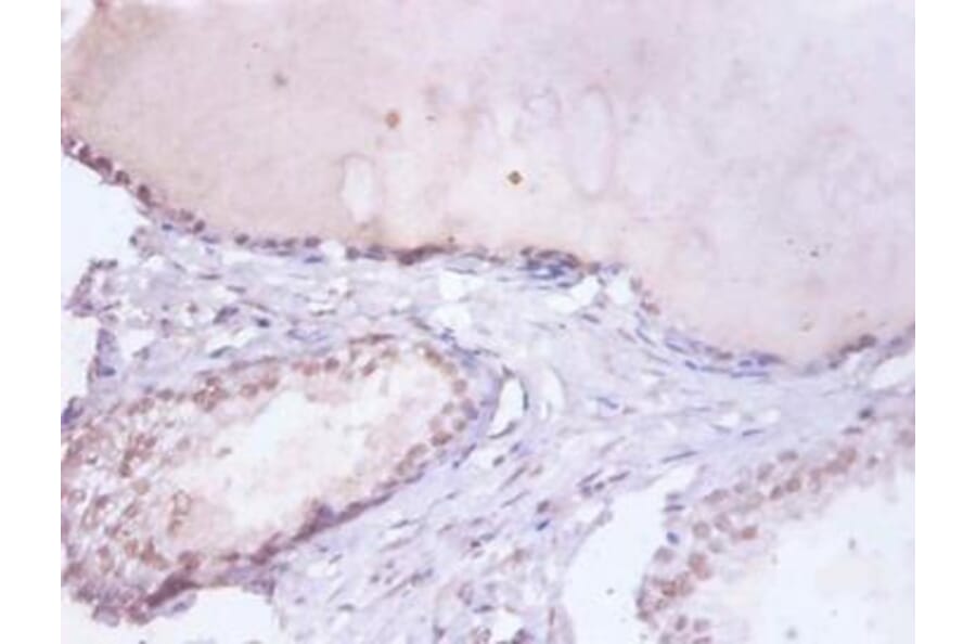 Immunohistochemistry - Heterogeneous nuclear ribonucleoprotein D0 Polyclonal Antibody from Signalway Antibody (42362)