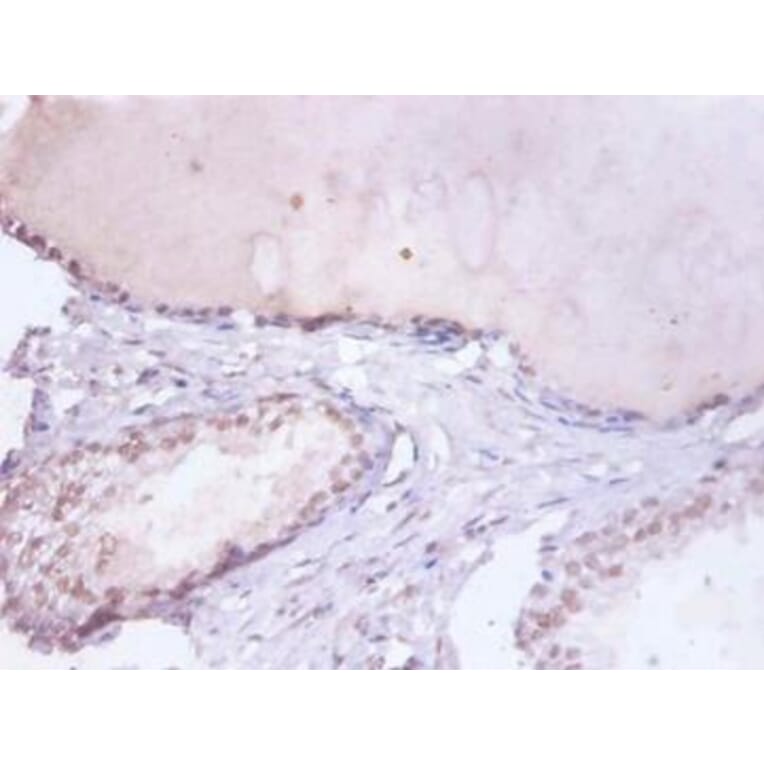 Immunohistochemistry - Heterogeneous nuclear ribonucleoprotein D0 Polyclonal Antibody from Signalway Antibody (42362)