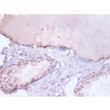 Immunohistochemistry - Heterogeneous nuclear ribonucleoprotein D0 Polyclonal Antibody from Signalway Antibody (42362)