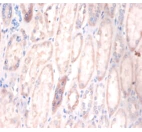 Immunohistochemistry - Cerebellar degeneration-related protein 2 Polyclonal Antibody from Signalway Antibody (42117)