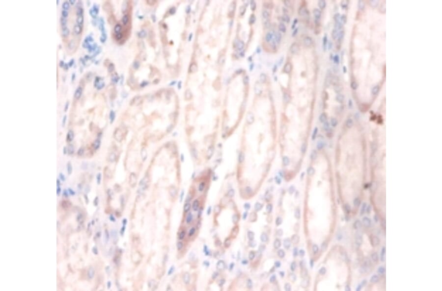 Immunohistochemistry - Cerebellar degeneration-related protein 2 Polyclonal Antibody from Signalway Antibody (42117)