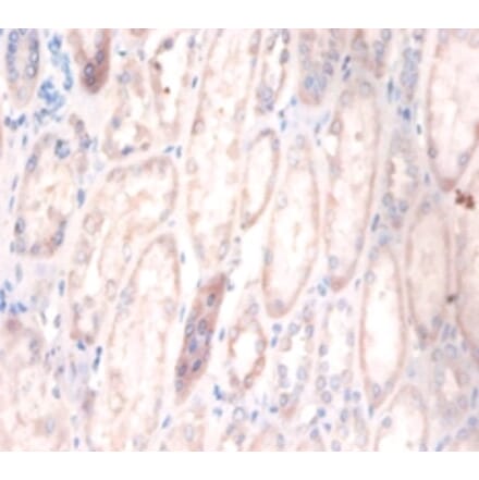 Immunohistochemistry - Cerebellar degeneration-related protein 2 Polyclonal Antibody from Signalway Antibody (42117)